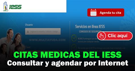 agendar cita médica iess|IESS Citas médicas: Agendar y consultar cita por internet y teléfono